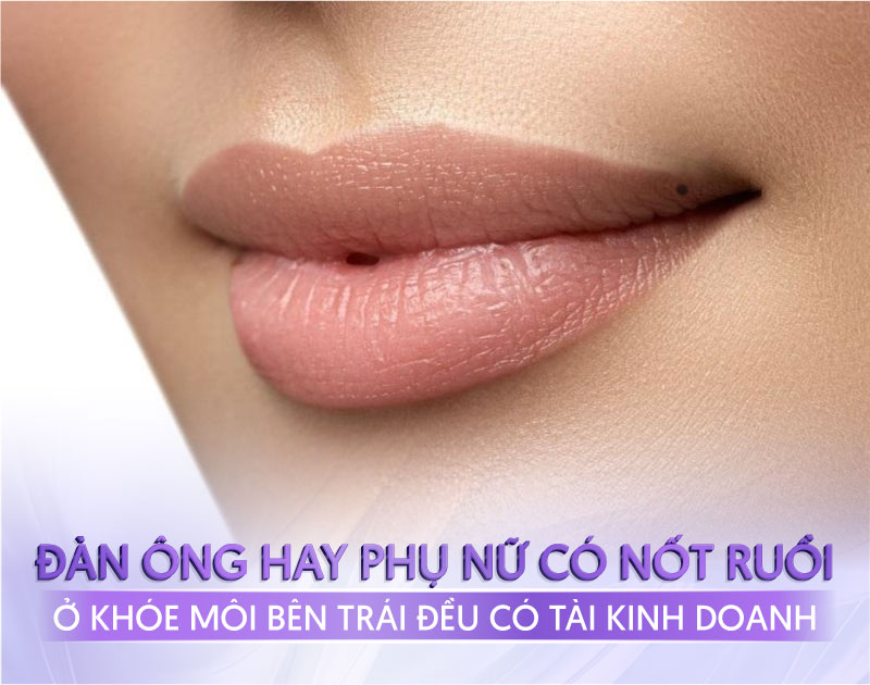 nốt ruồi dưới môi