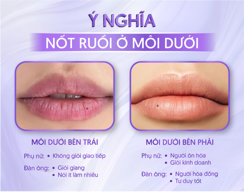 nốt ruồi ở môi dưới