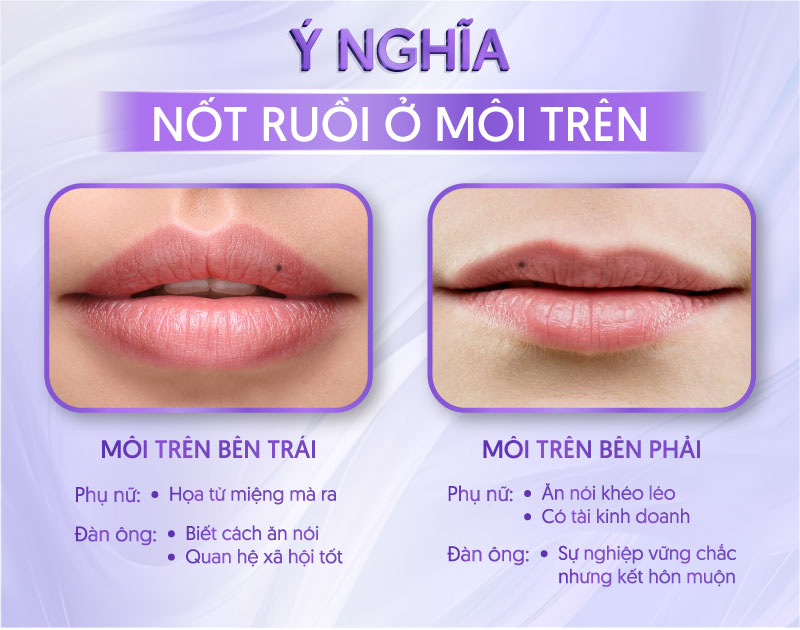 nốt ruồi ở môi trên