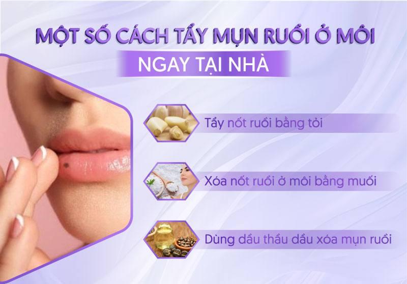 nốt ruồi trên môi dưới