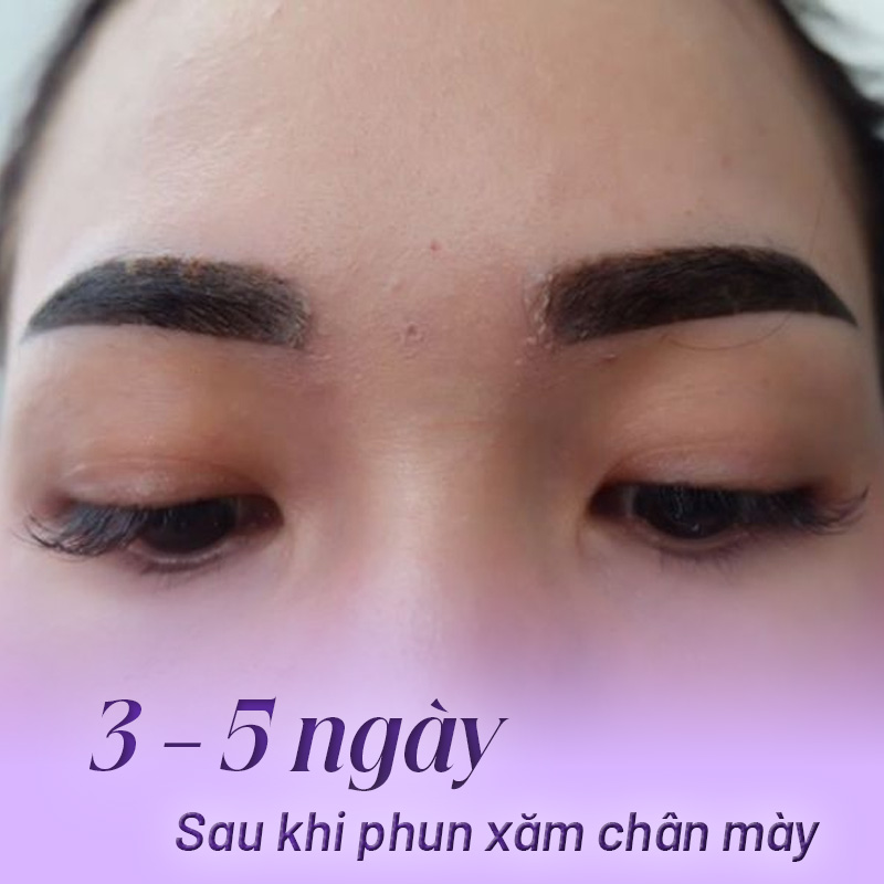 quá trình phục hồi mày sau phun xăm