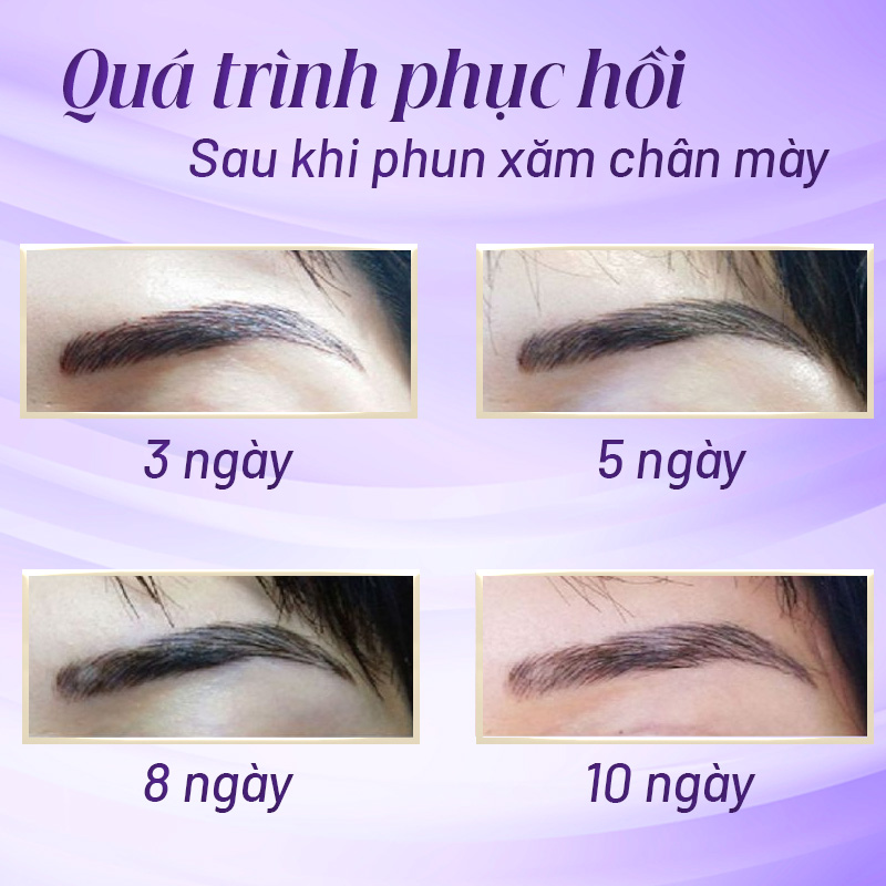 quy trình phục hồi chân mày