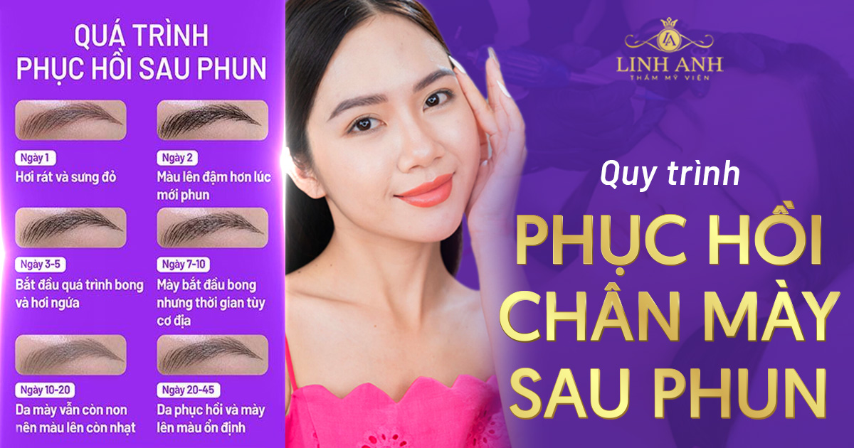 quy trình phục hồi mày sau phun