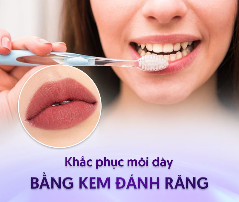 thế nào là môi dày