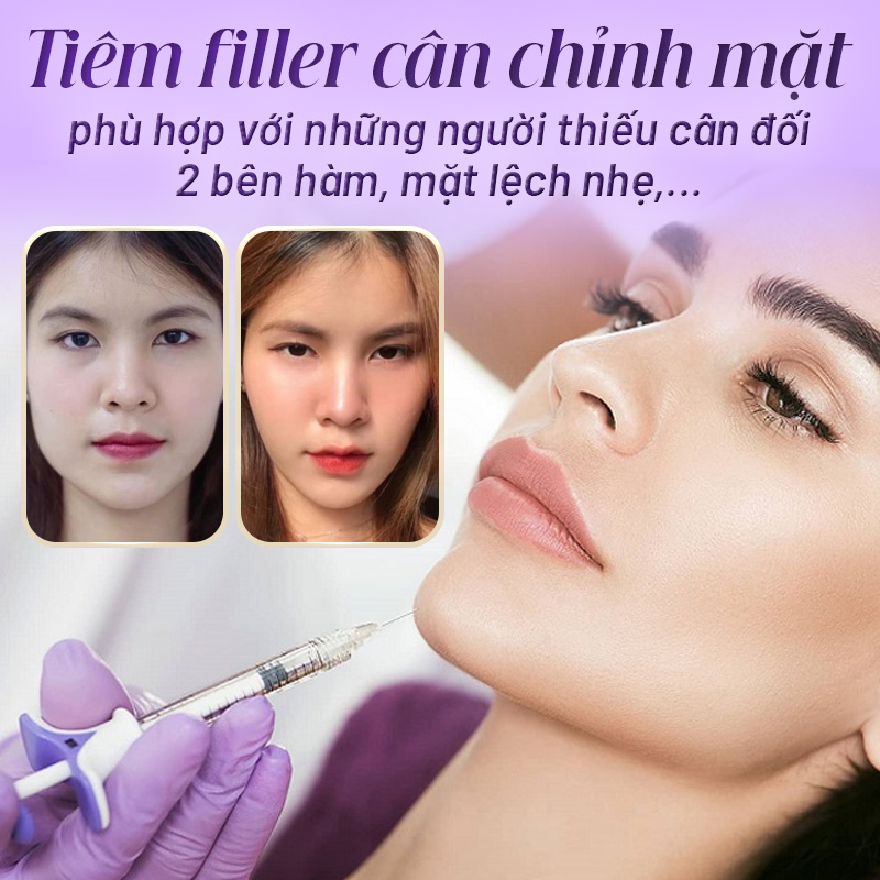 tiêm cân chỉnh mặt bao nhiêu tiền