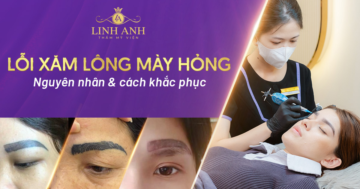 Xăm lông mày hỏng: Nguyên nhân & cách xử lý hiệu quả