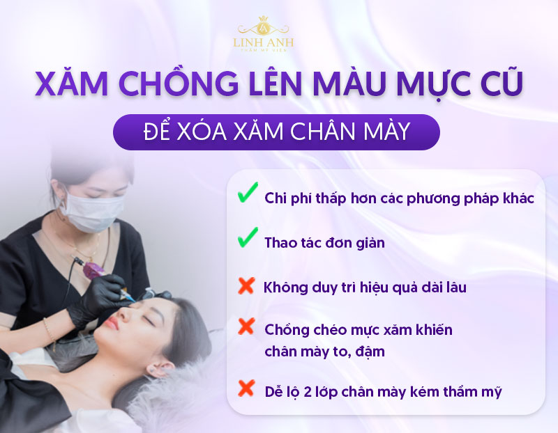 xoá chân mày phun