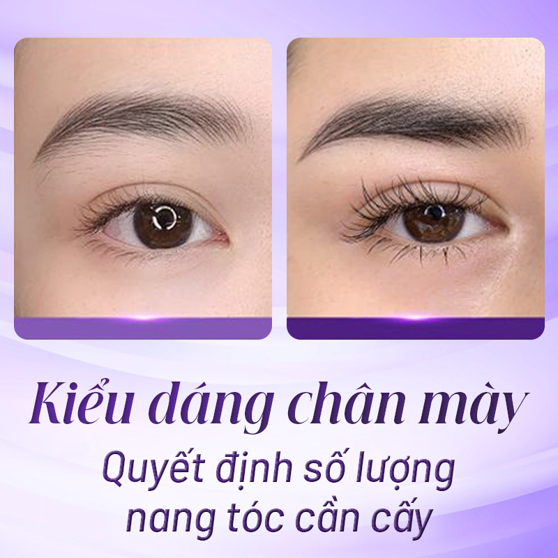 cấy chân mày giá bao nhiêu