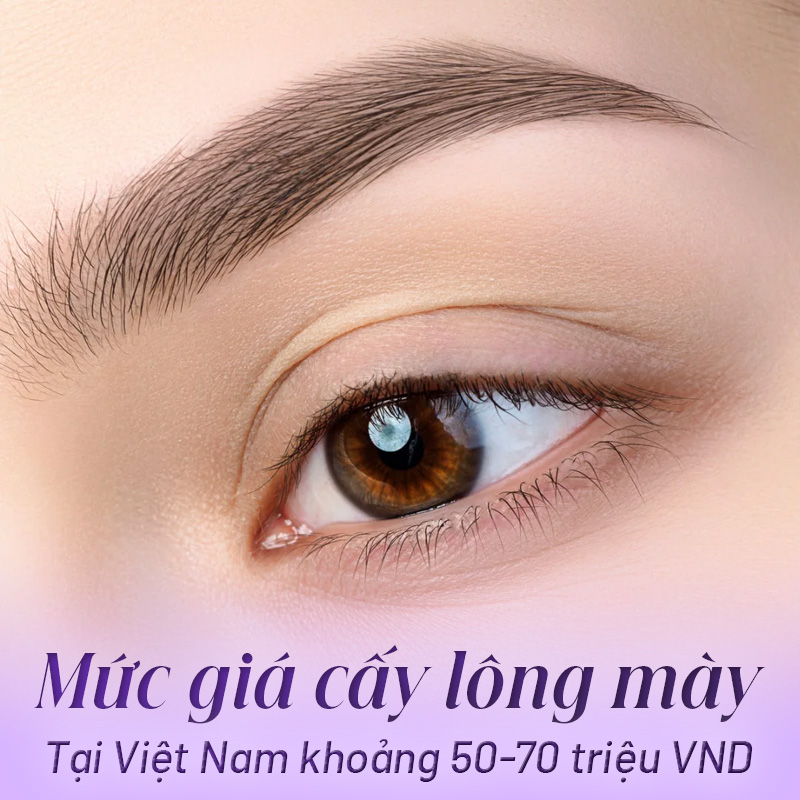 cấy lông mày hết bao nhiêu tiền