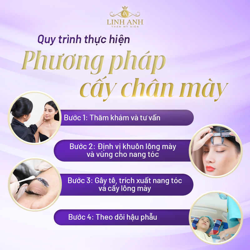 cấy lông mày là gì