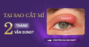 cắt mí 2 tháng vẫn sưng