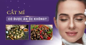 cắt mí có được ăn ốc không