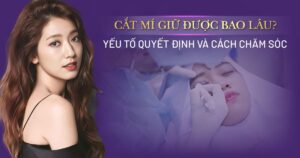 cắt mí giữ được bao lâu