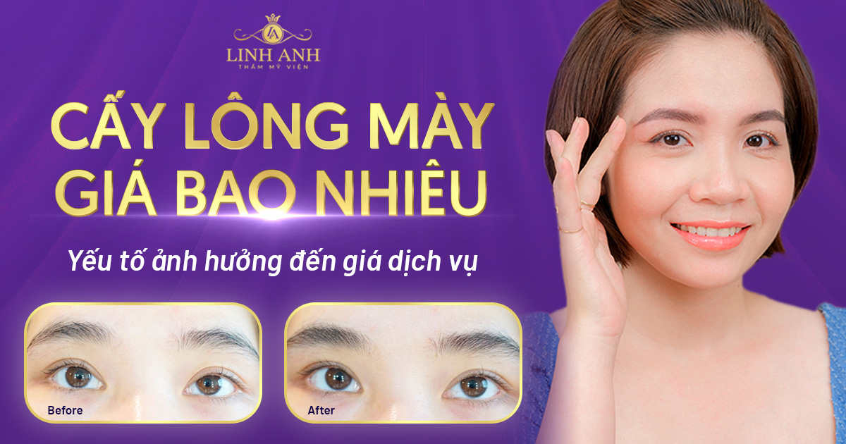 cấy lông mày giá bao nhiêu