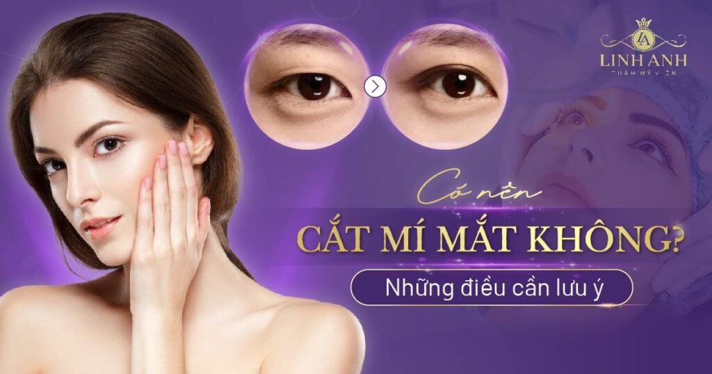 có nên cắt mí mắt không