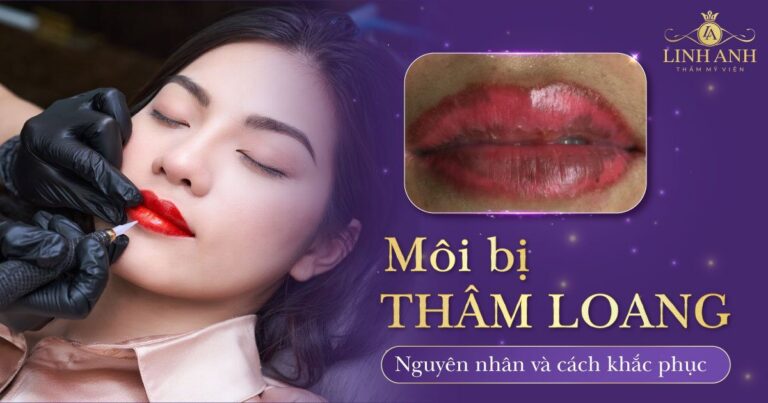 Nguyên nhân môi bị thâm loang sau khi bong và cách khắc phục