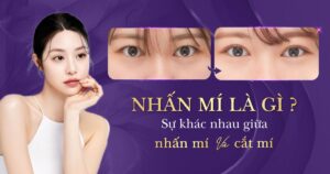 nhấn mí