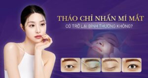 bao lâu thì tháo nhấn mí