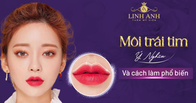 Môi trái tim: Đặc điểm, ý nghĩa nhân tướng học và cách sở hữu
