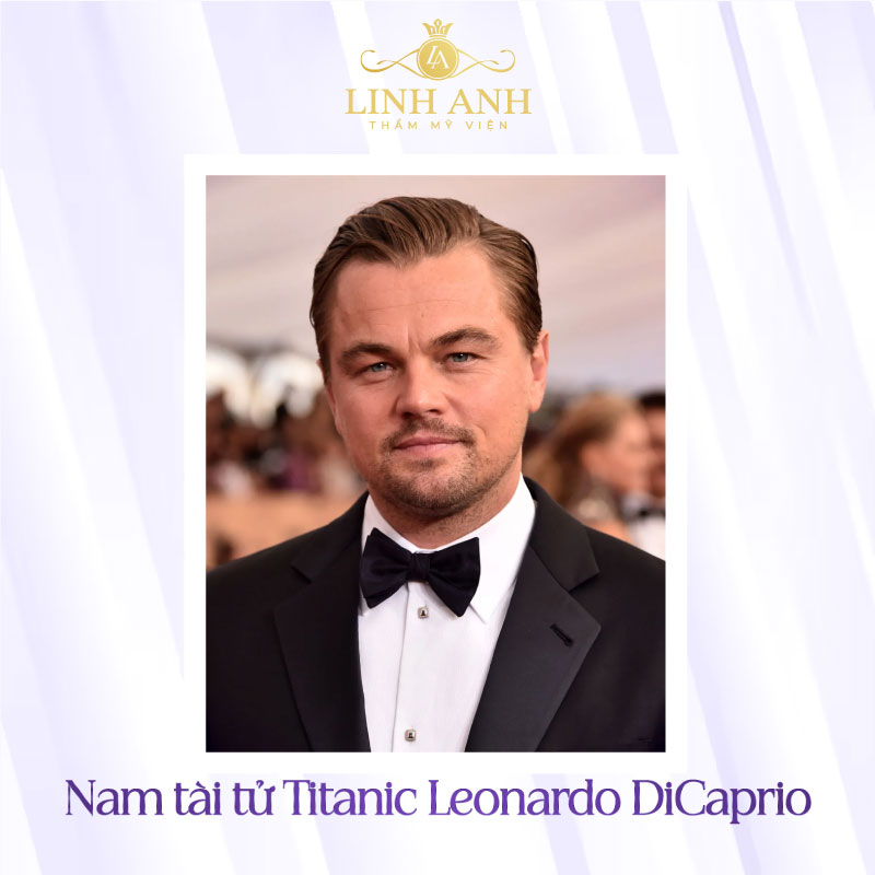 Leonardo DiCaprio có tướng trán chữ M