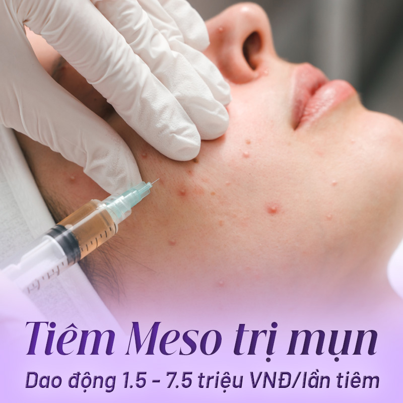 tiêm meso trị mụn có mắc không