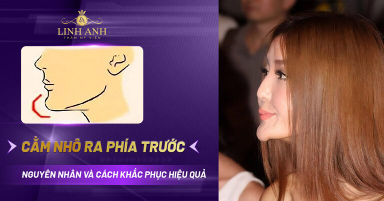 Cằm nhô ra phía trước: Nguyên nhân và cách khắc phục
