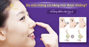 da mũi mỏng có nâng mũi được không