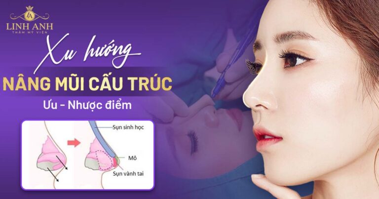 Nâng mũi cấu trúc là gì? Ưu, nhược điểm và những điều cần nắm