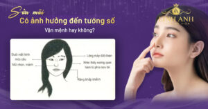 sửa mũi có ảnh hưởng đến tướng số