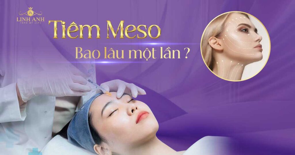 tiêm meso bao lâu 1 lần