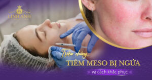 tiêm meso bị ngứa