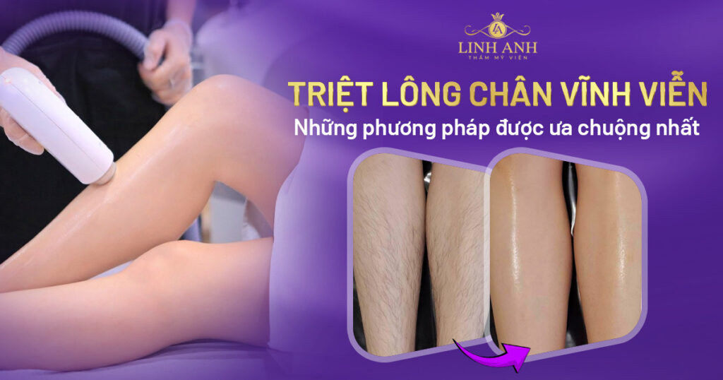 triệt lông chân