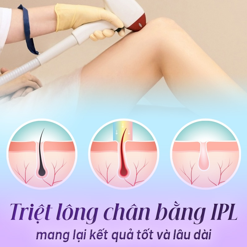 triệt lông chân có ảnh hưởng gì không