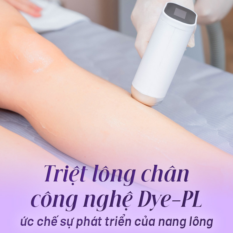 triệt lông chân nữ