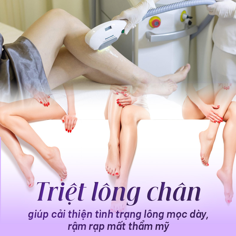 triệt lông chân vĩnh viễn