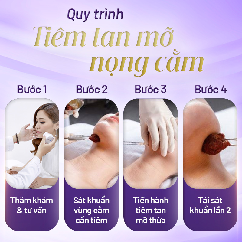 tiêm tan mỡ nọng cằm bao nhiêu tiền