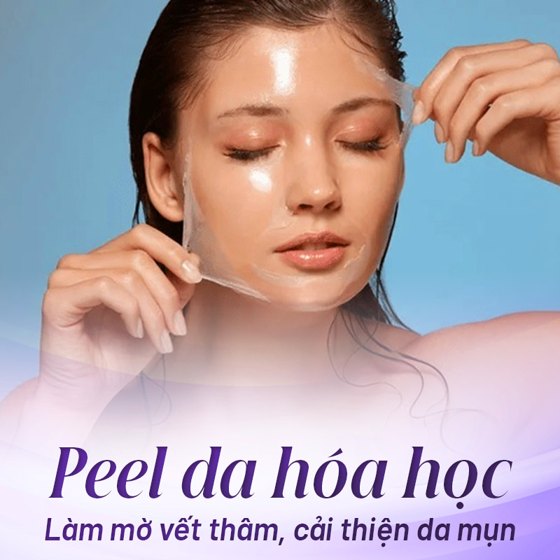 chi phí cấy trắng da mặt