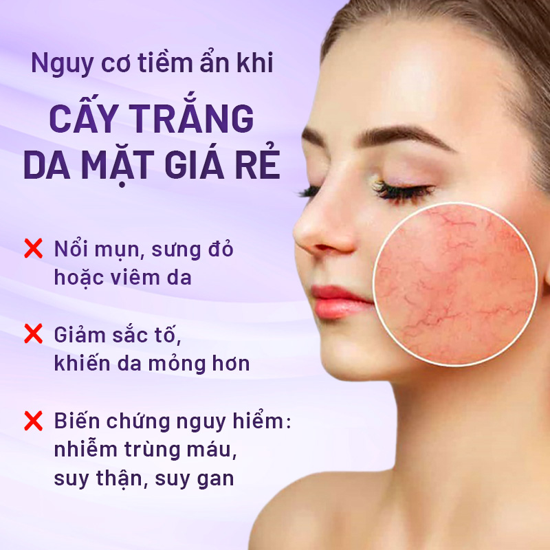 liệu trình cấy trắng da mặt