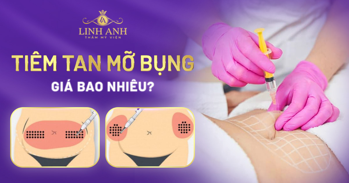 tiêm tan mỡ bụng giá bao nhiêu