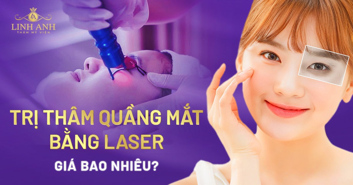 Trị thâm quầng mắt bằng Laser giá bao nhiêu? Yếu tố ảnh hưởng