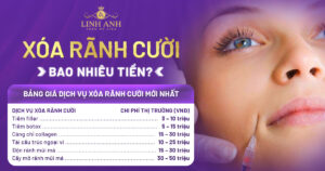 xóa rãnh cười bao nhiêu tiền