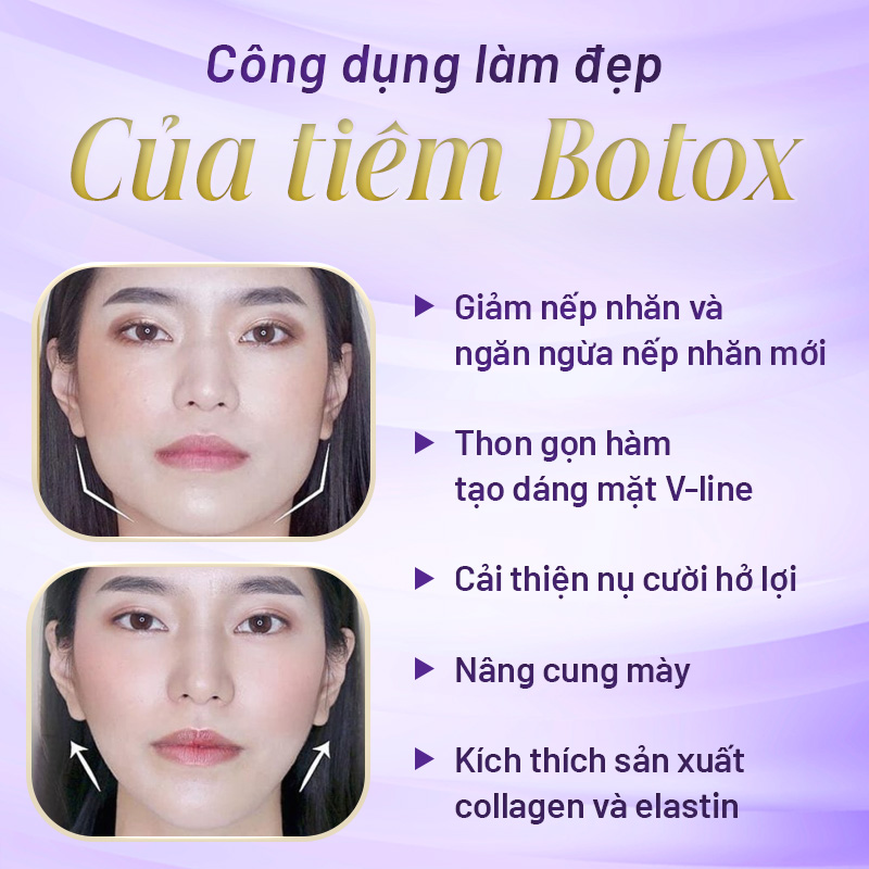 Công dụng của botox