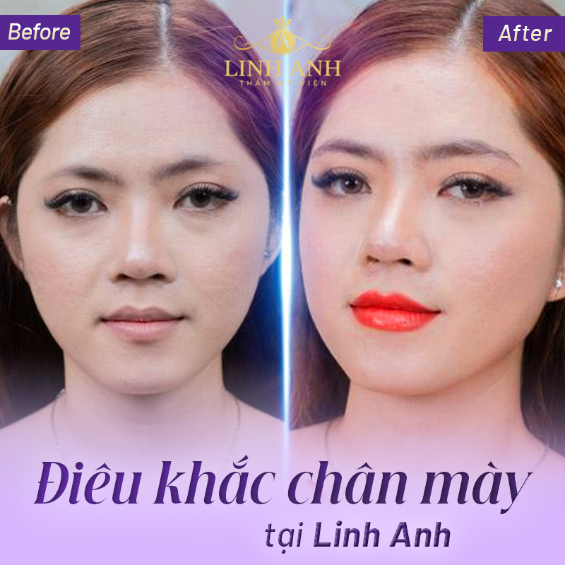 Lông mày không có đuôi nữ