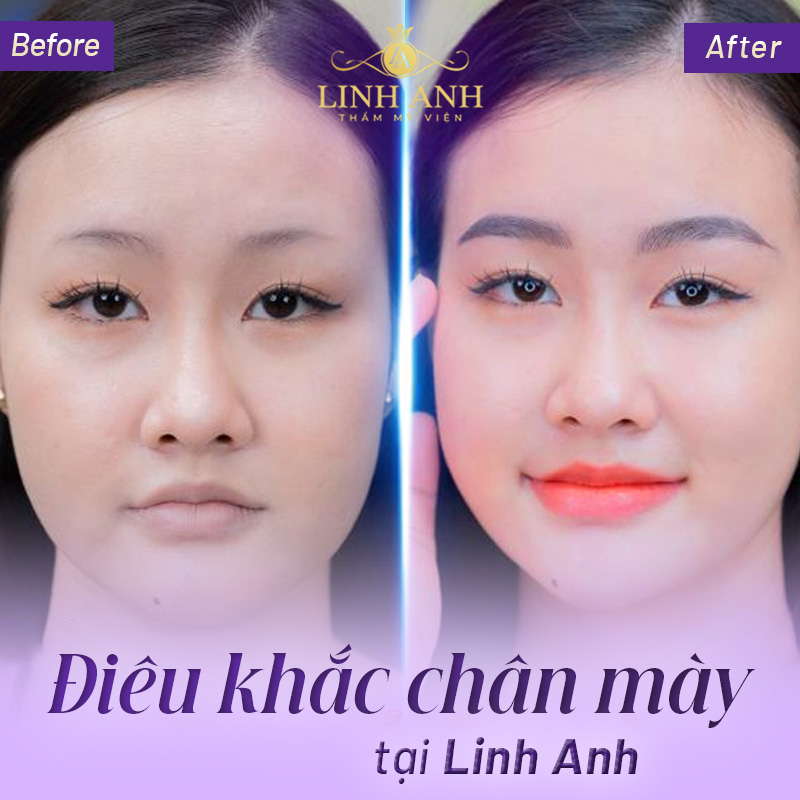 Lông mày ngắn nữ