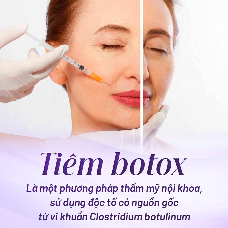 Tiêm botox là gì