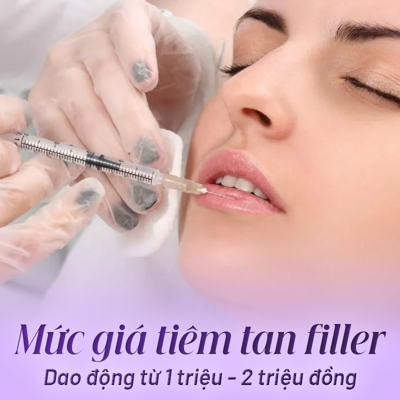 Tiêm tan filler bao nhiêu tiền