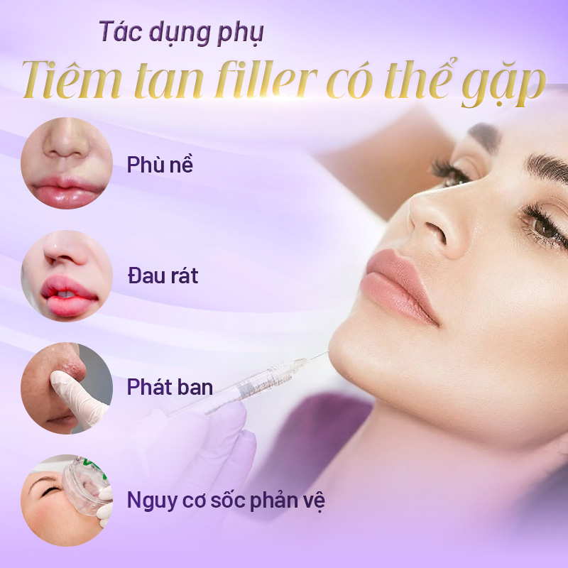 Tiêm tan filler hết bao nhiêu tiền