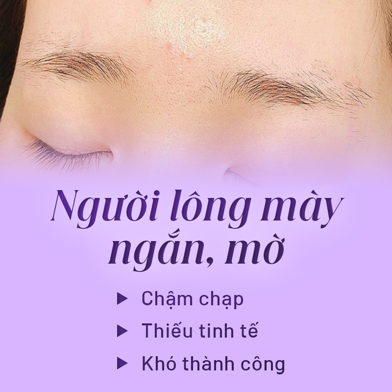 Tướng lông mày ngắn