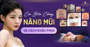 biến chứng nâng mũi