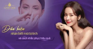 cách nhận biết mũi bị lệch